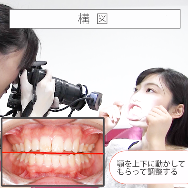 座位で撮る口腔内写真12枚法 06. 正面観手順