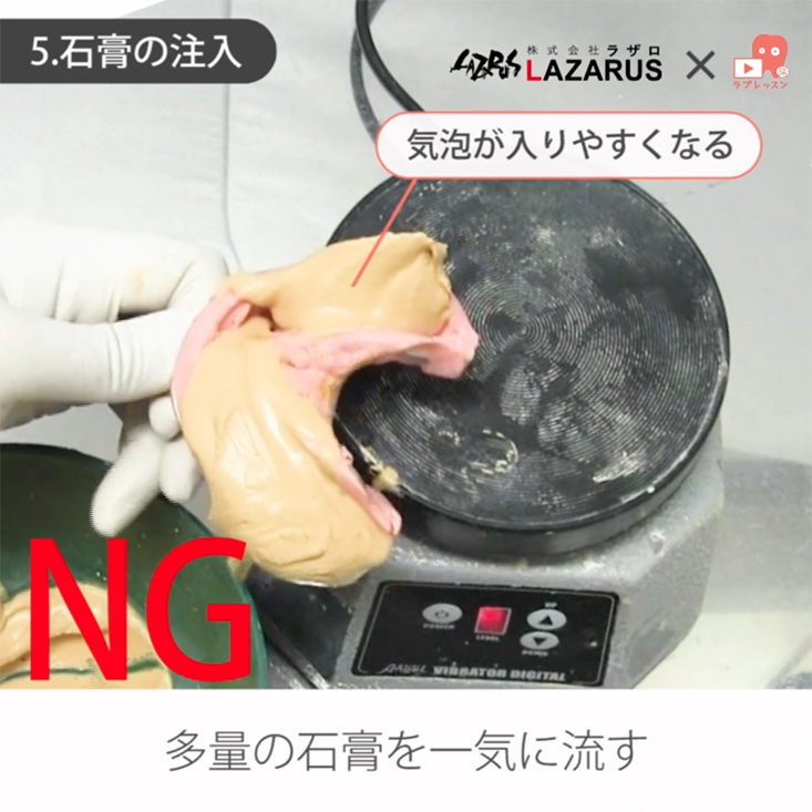 歯科技工 02.石膏の流し方注入撤去