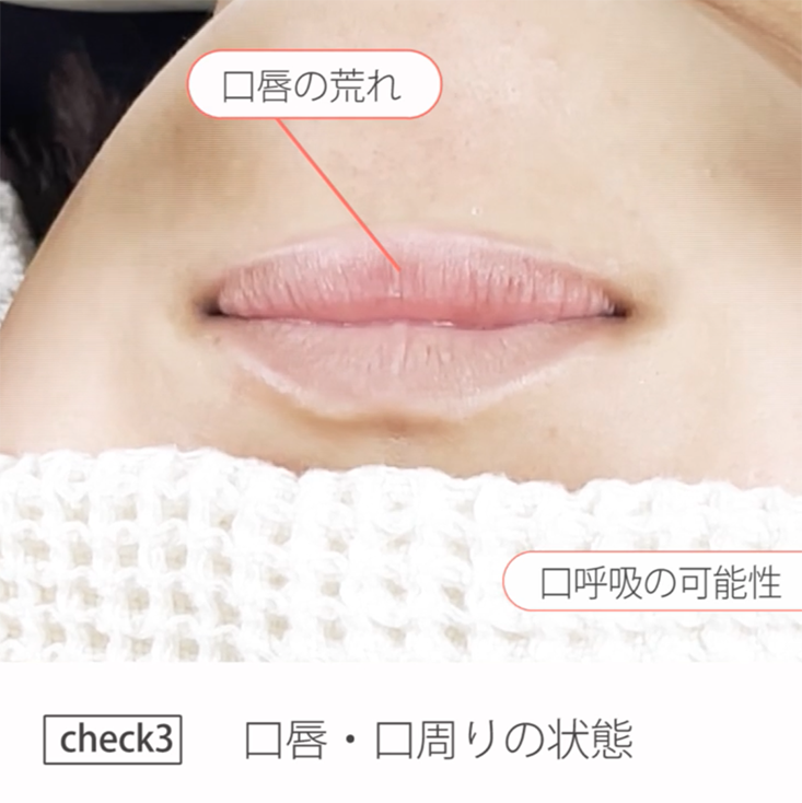 01.症例１ -20代女性- その１