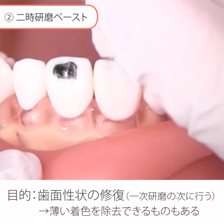 PMTCペースト"